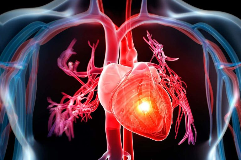 Crises cardiaques : Un test salivaire pourrait sauver des milliers de vies.