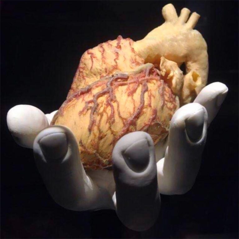 Les cœurs mécaniques peuvent-ils générer un nouveau tissu musculaire dans le cœur humain défaillant ?