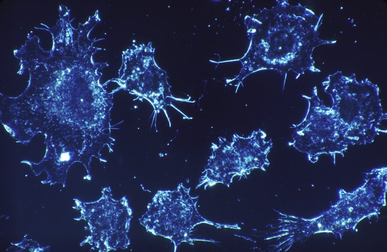 De nouvelles nano-capsules pour améliorer l’efficacité de l’oncothérapie chimiodynamique