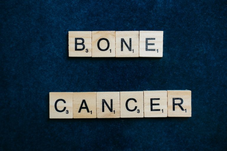 Une protéine de la matrice osseuse nouvellement identifiée pourrait aider à traiter l’ostéosarcome